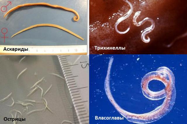 Главные признаки наличия паразитов в организме человека